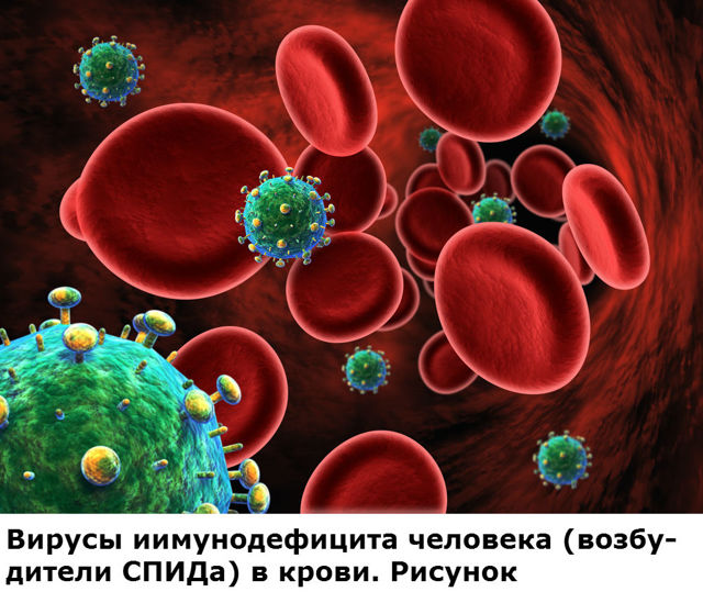 Сепсис - причины, симптомы и лечение заражения крови
