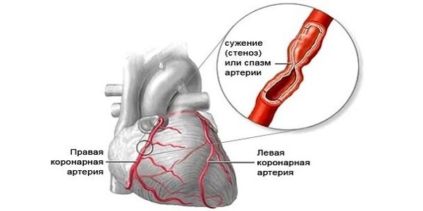 Почему сердце колит и что можно сделать в домашних условиях?