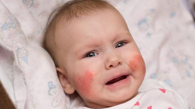 Понижены лимфоциты в крови у ребенка: причины, низкий уровень