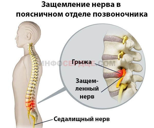 Что делать, если беспокоит жжение в области сердца