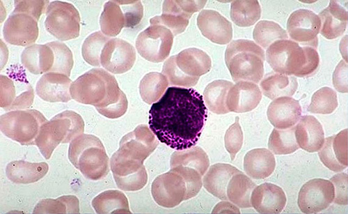 Если палочкоядерные нейтрофилы 0 у взрослого – о чем это говорит. Почему у ребенка повышены сегментоядерные и палочкоядерные нейтрофилы: причины высоких показателей в анализе крови