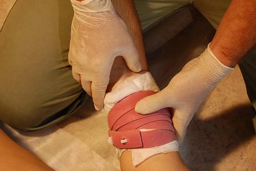 Синдром длительного раздавливания (СДР)