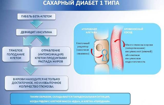 Диагностика и лечение СД.