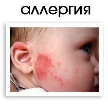 Цинковая мазь цена от 16 руб, Цинковая мазь купить в Москве, инструкция по применению, аналоги, отзывы