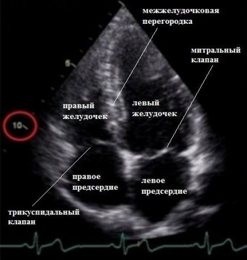Расшифровка УЗИ сердца у детей: нормы по возрастам