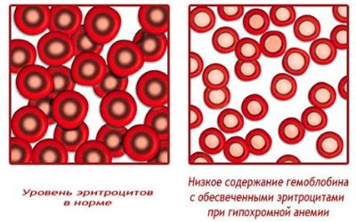 Анизохромия что это такое