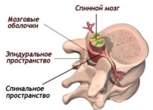 Предпосылки инсульта головного мозга у женщин - как избежать инсульта у женщин