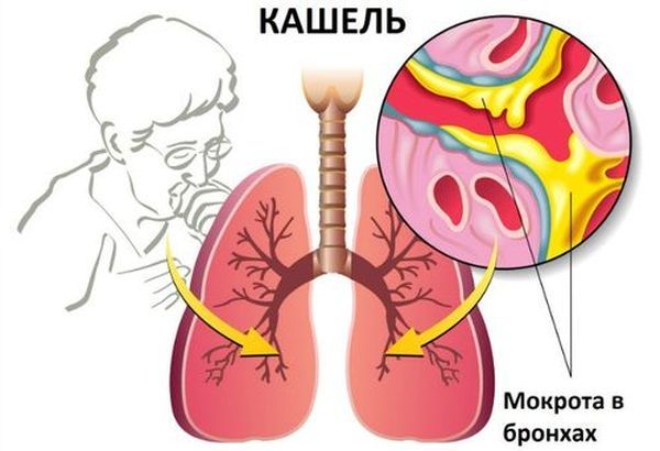 Детский сироп Лазолван: инструкция по применению для детей, при сухом кашле, до года