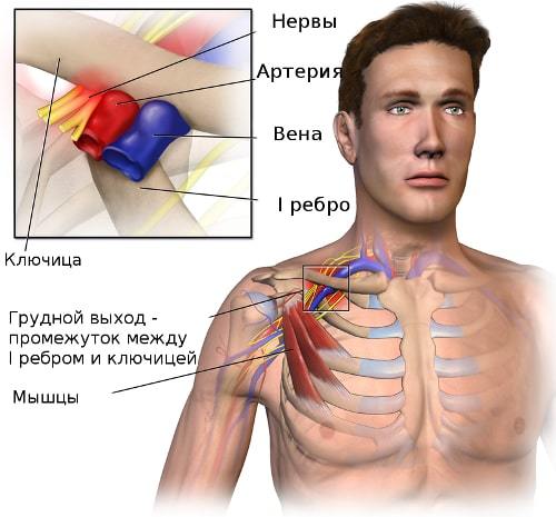 Боль в ключице, болит правая или левая ключица