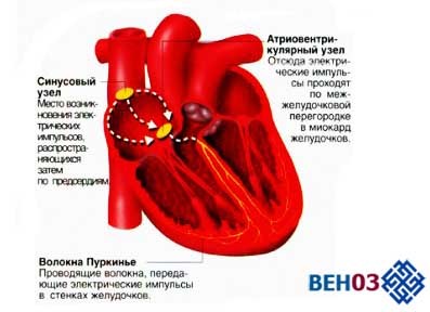 Лечится ли аритмия сердца