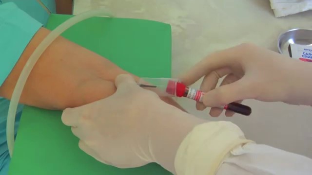Анализ крови на стерильность – зачем нужен и кому показан?