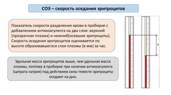 СОЭ в анализе крови: расшифровка, причины отклонений