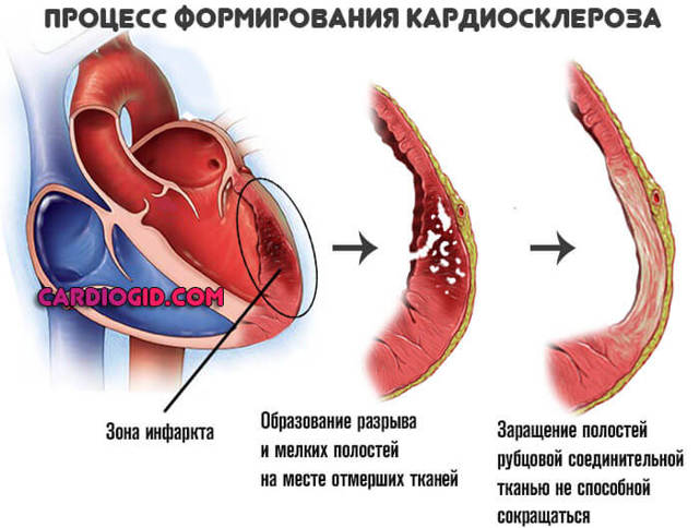 Пульс 73 удара в минуту это нормально - Все про гипертонию