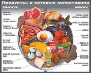 Атеросклероз сердца: симптомы и лечение