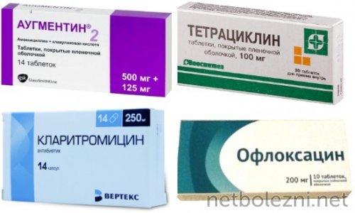 Зеленая мокрота при кашле