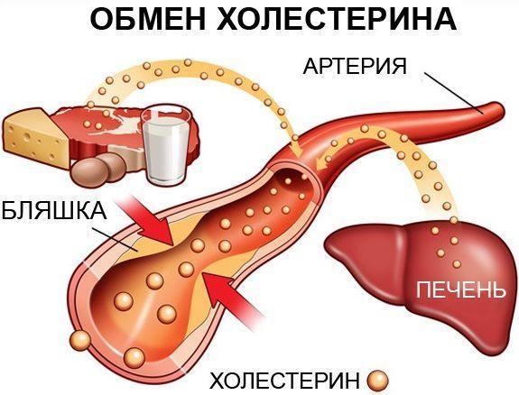 Артериальная гипертензия 2 степени: лечение, причины