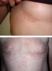 БИФОСИН - инструкция по применению, противопоказания, отзывы