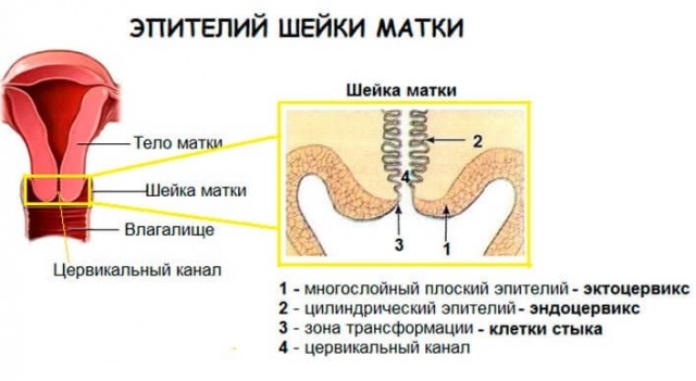 Онкоцитология шейки матки - мазок на онкоцитологию. Цитограмма воспаления с расшифровкой