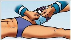 Виды кровотечений и оказание первой помощи