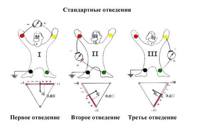 ЭКГ сердца - алгоритм действия (рекомендации)