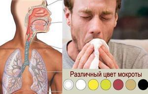 При кашле отхаркивается слизь коричневая