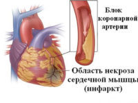 Коагулограмма - что это за анализ, как подготовиться, где сдавать, расшифровка результатов у взрослых, детей, беременных