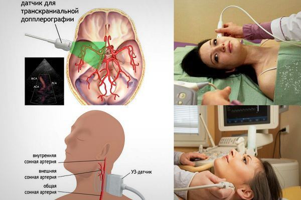 УЗДГ БЦА: что это такое, показания, проведение, расшифровка результатов