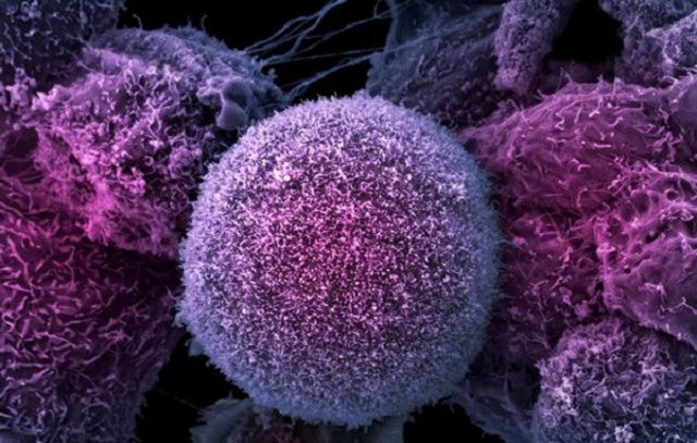 ЛИМФОЦИТЫ В КРОВИ У РЕБЕНКА ПОВЫШЕНЫ: [причины, лечение]