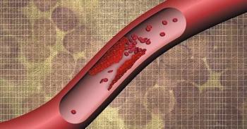 АНГИОФЛЮКС - инструкция по применению, цена, отзывы и аналоги