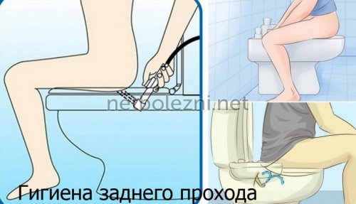 Геморрой при беременности - чем и как лечить геморрой беременной?