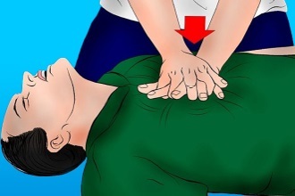 Закрытый массаж сердца., Методика выполнения закрытого массажа сердца - Основы реанимации