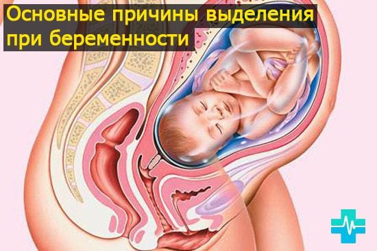 Выделения красные, но не месячные: причины