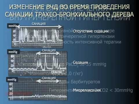 Давление 109 на 67 - Лечение гипертонии
