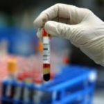 Анализ крови на ХГЧ: что это такое, когда сдавать