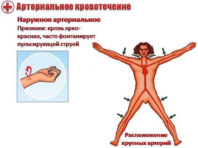 Виды кровотечений и оказание первой помощи