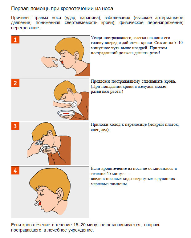 Кровь из носа, что делать