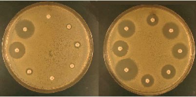 Посев крови - что это, что показывает бактериологический посев