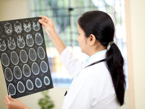 Киста сосудистого сплетения головного мозга: возникновение, диагностика, лечение. Опасна ли киста сосудистого сплетения для новорожденного?