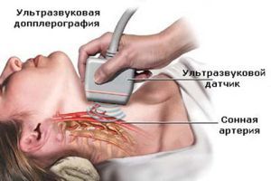 Сосудистый генез головного мозга: что это такое и как его лечить
