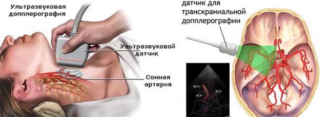 УЗДГ БЦА: что это такое, показания, расшифровка