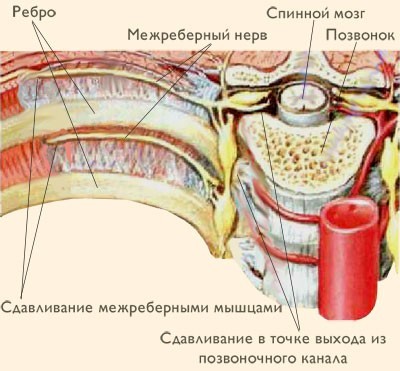 Колит в левом боку под ребрами спереди при вдохе, в области сердца, сбоку, сзади. Что это может быть у женщин, мужчин