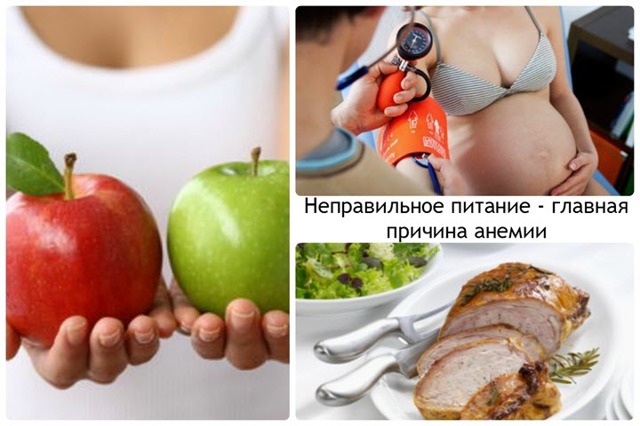 Анемия 2 степени - что это такое, симптомы и лечение