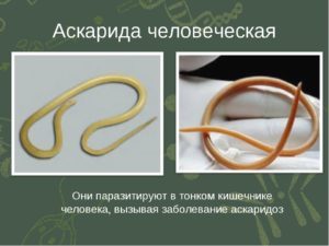 Эозинофилы при астме. Эозинофилия