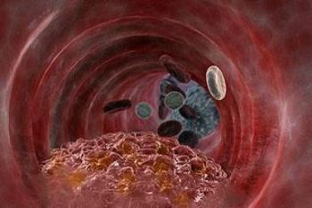 Вазапростан - инструкция по применению, описание, отзывы пациентов и врачей, аналоги