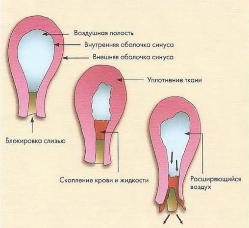 Ночью кровь во рту. Кровь во рту после сна. Причины появления привкуса крови