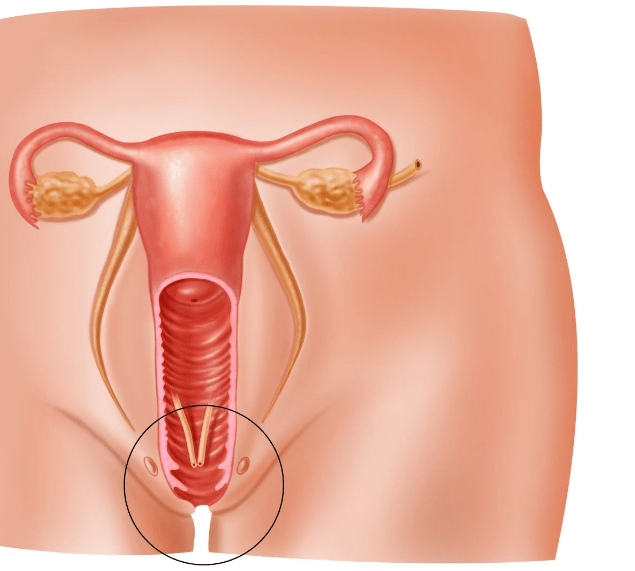 Вульвит у женщин – симптомы и лечение, фото