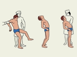 Мышечная гипотония у новорожденных и детей