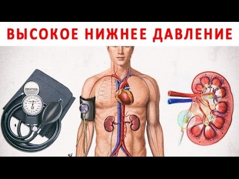 Высокое нижнее давление - причины и лечение в домашних условиях