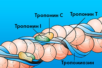 Тропониновый тест при инфаркте миокарда – что это такое: инструкция по проведению и расшифровка теста на тропонин