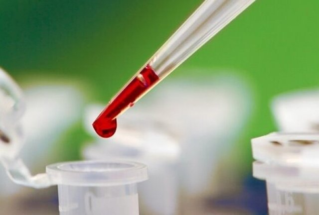 Заболевания по группе крови (болезни, влияющие на здоровье)